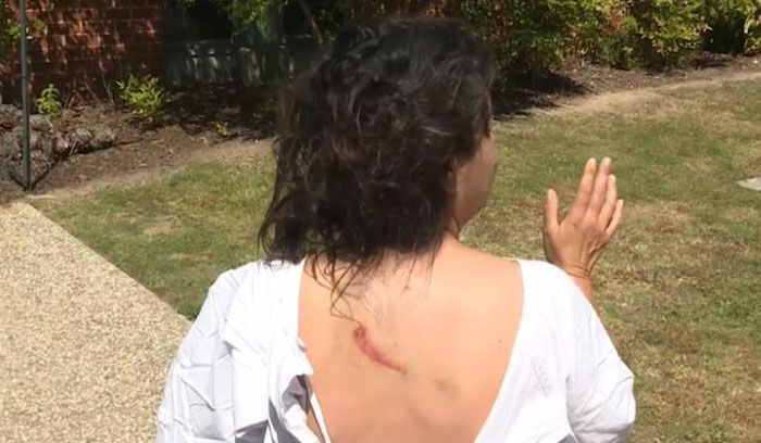 Woman mauled by kangaroo